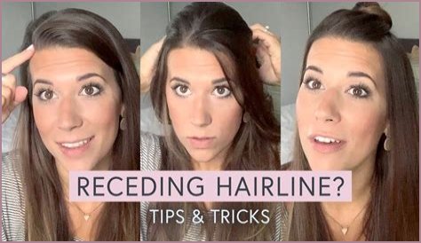 What hairstyle is best for receding hairline?